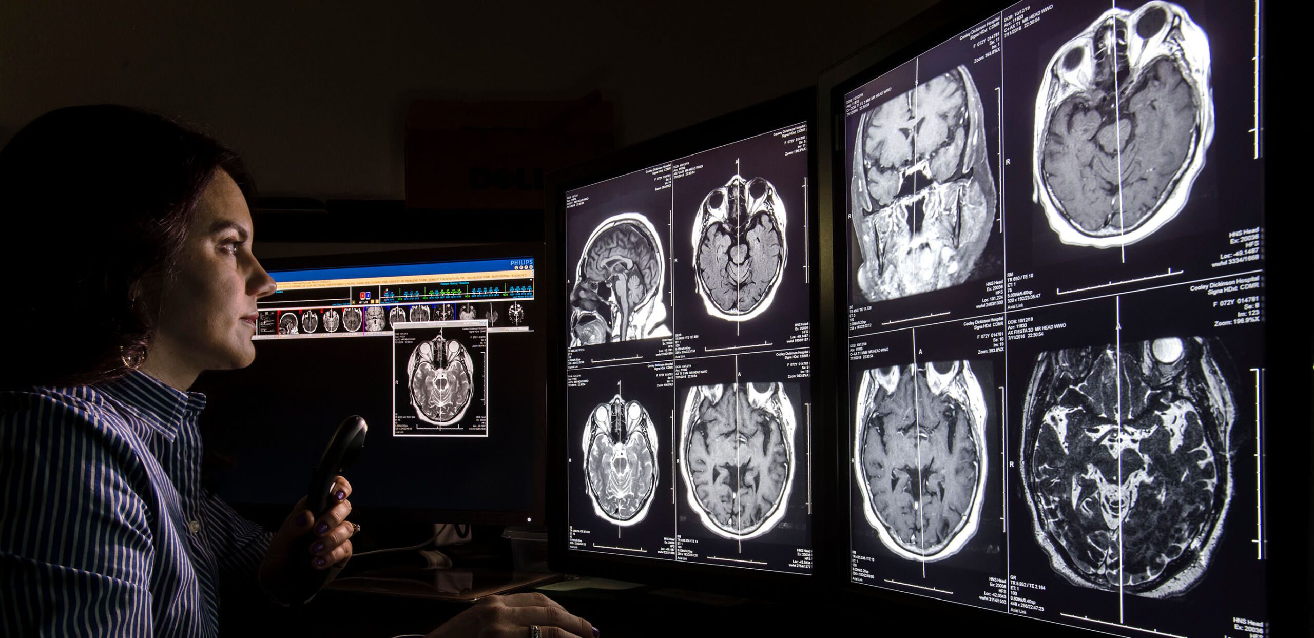 Radiologist Brooke Breen, MD, dictates notes while reviewing MRI scans of a patient's brain at Cooley Dickinson Hospital, 30 Locust Street, Northampton, MA 01060.